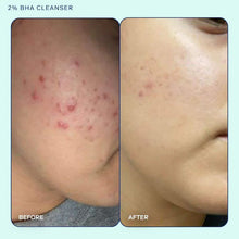 Acne+ 2% BHA + Azelaic Acid + Niacinamide + AHA Cleanser