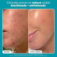 Mini Skin Perfecting 2% BHA Exfoliating Toner for Clear Skin