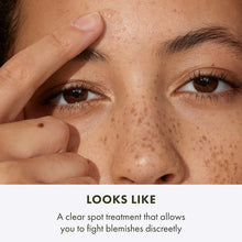 Super Spot Remover™ Acne Treatment Gel with Salicylic Acid